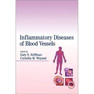 Inflammatory Diseases of Blood Vessels by Hoffman,Gary S., 9780824702694