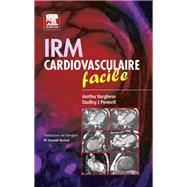 IRM cardiovasculaire facile by Anitha Varghese; Dudley J. Pennell; Lionel Arriv; John Scott & Co, 9782294102738