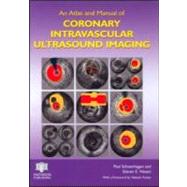 An Atlas and Manual of Coronary Intravascular Ultrasound Imaging by Schoenhagen; Paul, 9781842142745