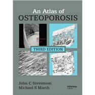 An Atlas of Osteoporosis by Stevenson, John C.; Marsh, Michael S., 9780367452810
