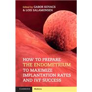 How to Prepare the Endometrium to Maximize Implantation Rates and Ivf Success by Kovacs, Gabor; Salamonsen, Lois, 9781108402811