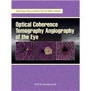 Optical Coherence Tomography Angiography of the Eye by Huang, David; Lumbroso, Bruno; Jia, Yali; Waheed, Nadia K., 9781630912826