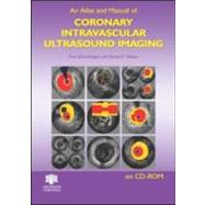 An Atlas and Manual of Coronary Intravascular Ultrasound Imaging by Schoenhagen; Paul, 9781842142929