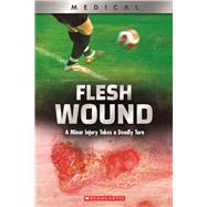 Flesh Wound: A Minor Injury Takes a Deadly Turn (XBooks) by Phillips, Shea, 9780531132968