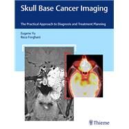 Skull Base Cancer Imaging by Yu, Eugene, M.D.; Forghani, Reza, M.D., Ph.D., 9781626232969