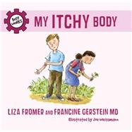 My Itchy Body by Fromer, Liza; Gerstein, Francine; Weissmann, Joe, 9781770493117