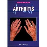 Arthritis by Willett, Edward, 9780766013148