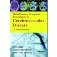 Multidetector Computed Tomography in Cerebrovascular Disease: CT Perfusion Imaging by Miles; Kenneth, 9781842143155
