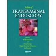 Atlas of Transvaginal Endoscopy by Gordts; Stephan, 9781842143209