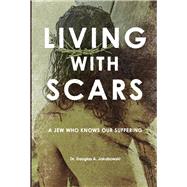Living with Scars A Jew Who Knows Our Suffering by Jakubowski, Douglas, 9780578653235