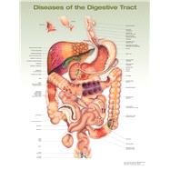 Diseases of the Digestive Tract Anatomical Chart by Unknown, 9781975243258