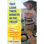 They Leave Their Kidneys in the Fields by Horton, Sarah Bronwen, 9780520283275