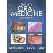 Burkett's Oral Medicine (Book with CD-ROM) by Greenberg, Martin S., 9781550093452