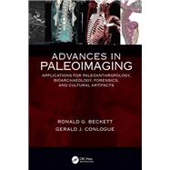 Advances in Paleoimaging by Beckett, Ronald G.; Conlogue, Gerald J., 9781138703599