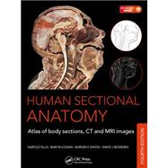 Human Sectional Anatomy: Atlas of Body Sections, CT and MRI Images, Fourth Edition by Dixon; Adrian K., 9781498703604