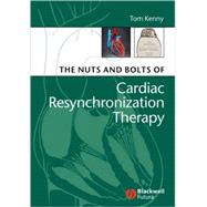 The Nuts and Bolts of Cardiac Resynchronization Therapy by Kenny, Tom, 9781405153720