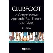 Clubfoot by Mittal, R. L., 9781138083738