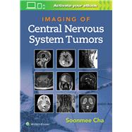 Imaging of Central Nervous System Tumors by Cha, Soonme, 9781975103743