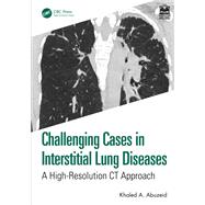 Challenging Cases in Interstitial Lung Diseases by Khaled Ahmed Abuzeid, 9781040353745