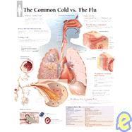 The Common Cold vs Flu chart Laminated Wall Chart by Unknown, 9781930633797