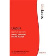 Lupus by Isenberg, David; Manzi, Susan, 9780199213870