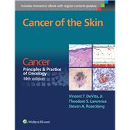 Cancer of the Skin Cancer:  Principles & Practice of Oncology, 10th edition by DeVita , Vincent T; Lawrence, Theodore S.; Rosenberg, Steven A., 9781496333933
