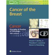 Cancer of the Breast From Cancer:  Principles & Practice of Oncology, 10th edition by DeVita, Vincent T.; Lawrence, Theodore S.; Rosenberg, Steven A., 9781496333988
