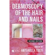 Dermoscopy of the Hair and Nails, Second Edition by Tosti (dup error); Antonella, 9781482234053
