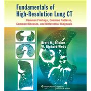Fundamentals of High-Resolution Lung CT: Common Findings, Common Patterns, Common Diseases, and Differential Diagnosis Common Findings, Common Patterns, Common Diseases, and Differential Diagnosis by Elicker, Brett M; Webb, W. Richard, 9781451184082