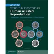 Atlas of Vitrified Blastocysts in Human Assisted Reproduction by Ebner, Thomas; Vanderzwalmen, Pierre; Wirleitner, Barbara, 9781107074095
