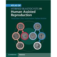 Atlas of Vitrified Blastocysts in Human Assisted Reproduction by Ebner, Thomas; Vanderzwalmen, Pierre; Wirleitner, Barbara, 9781107074095