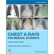 Chest X-Rays for Medical Students CXRs Made Easy by Clarke, Christopher; Dux, Anthony, 9781119504153