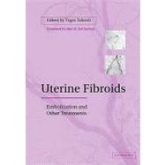 Uterine Fibroids: Embolization and other Treatments by Edited by Togas Tulandi, 9780521184199