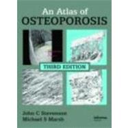 An Atlas of Osteoporosis, Third Edition by Stevenson; John C., 9780415404297