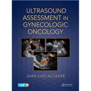 Ultrasound Assessment in Gynecologic Oncology by Alcazar, Juan Luis, M.D., Ph.D., 9781138044326