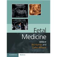 Fetal Medicine by Kumar, Bidyut, M.D.; Alfirevic, Zarko, M.D., 9781107064348