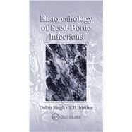 Histopathology of Seed-Borne Infections by Singh, Dalbir; Mathur, S. B., 9780367454357