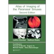 Atlas of Imaging of the Paranasal Sinuses, Second Edition by Shankar; Lalitha, 9781841844480