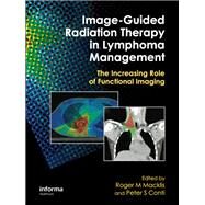 Image-guided Radiation Therapy in Lymphoma Management by Macklis, Roger M.; Conti, Peter S., 9780367384487
