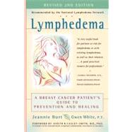 Lymphedema : A Breast Cancer Patient's Guide to Prevention and Healing by Burt, Jeannie; White, Gwen, 9780897934589