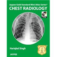Chest Radiology by Singh, Hariqbal, M.D.; Pawar, Abhijit (CON); Dongre, Aditi, M.D. (CON); Nade, Amol (CON); Sasane, Amol, M.D. (CON), 9789350904633