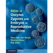 Atlas of Oocytes, Zygotes and Embryos in Reproductive Medicine by Van Den Bergh, Marc; Ebner, Thomas; Elder, Kay, 9781107004641
