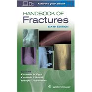 Handbook of Fractures by Egol, Kenneth, 9781496384850