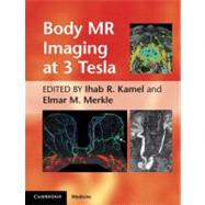 Body MR Imaging at 3 Tesla by Edited by Ihab R. Kamel , Elmar M. Merkle, 9780521194860