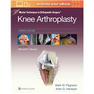 Master Techniques in Orthopedic Surgery: Knee Arthroplasty by Pagnano, Mark W., 9781496315052