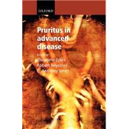 Pruritus in Advanced Disease by Zylicz, Zbigniew; Twycross, Robert; Jones, E. Anthony, 9780198525103