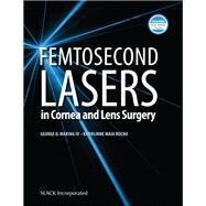 Femtosecond Lasers in Cornea and Lens Surgery by Waring, G.; Rocha, K., 9781630915124