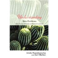 Understanding Skin Problems Acne, Eczema, Psoriasis and Related Conditions by Papadopoulos, Linda; Walker, Carl, 9780470845189
