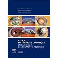 Atlas de tcnicas complejas en la ciruga del segmento anterior by Jos Belmonte Martnez, Ezequiel Campos Mollo, Javier Belmonte Martn, 9788490225189
