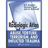 A Radiologic Atlas of Abuse, Torture, Terrorism, and Inflicted Trauma by Brogdon; B. G., 9780849315336